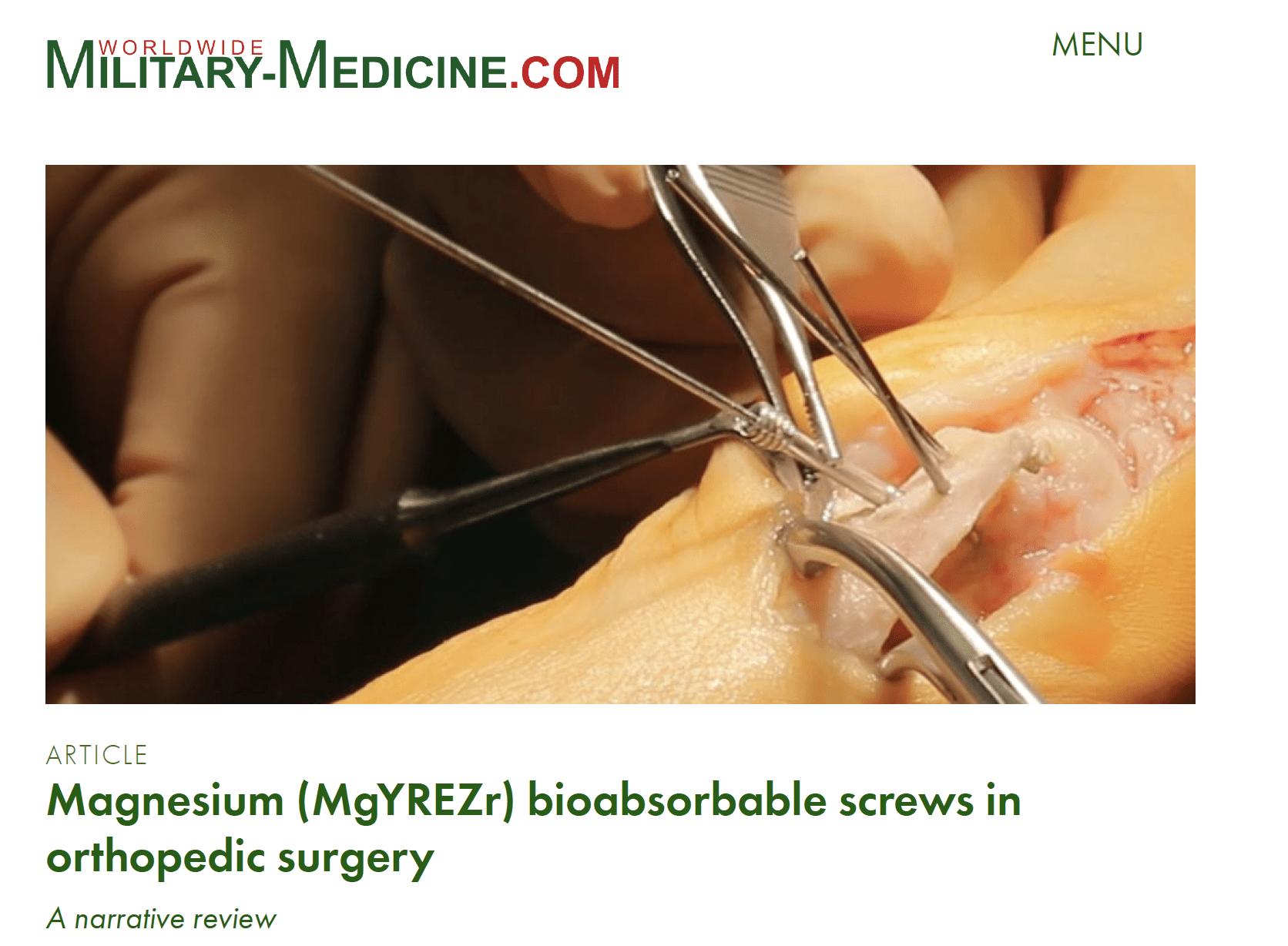 Magnesium bioabsorbable screws in orthopedic surgery